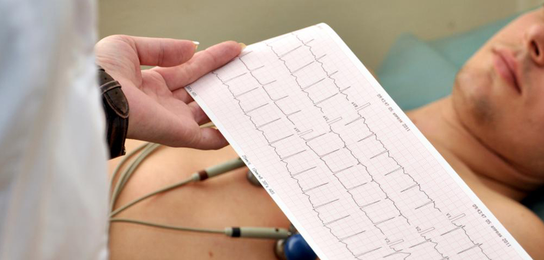 Electrocardiografía - Hospital de Peñaflor