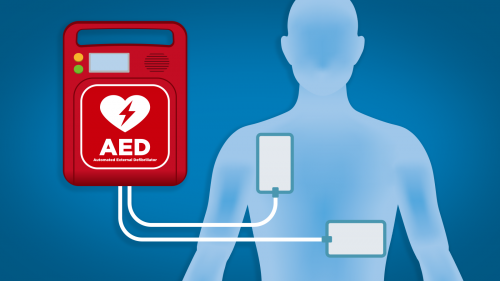 ACLS